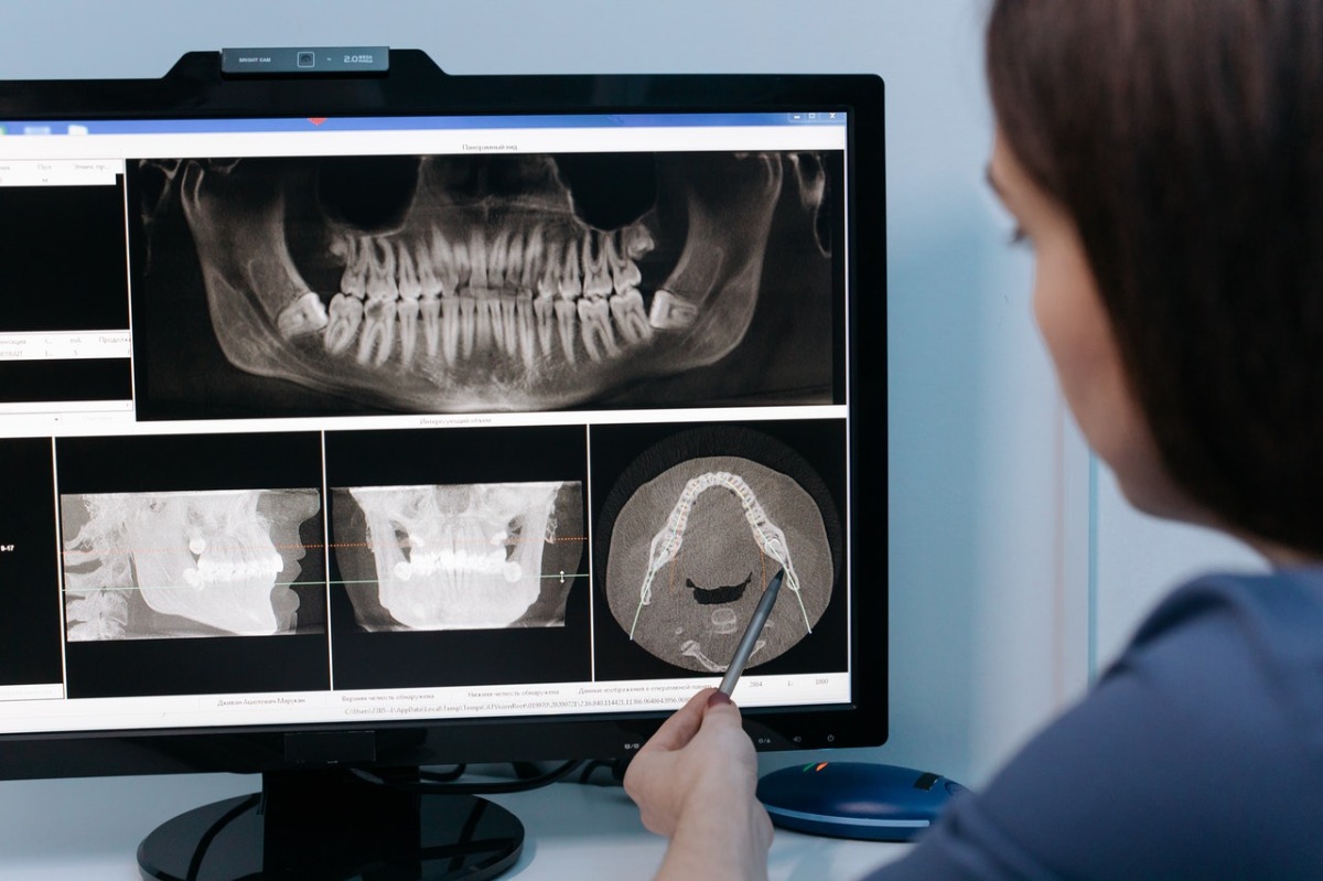dentist looking at x-ray images
