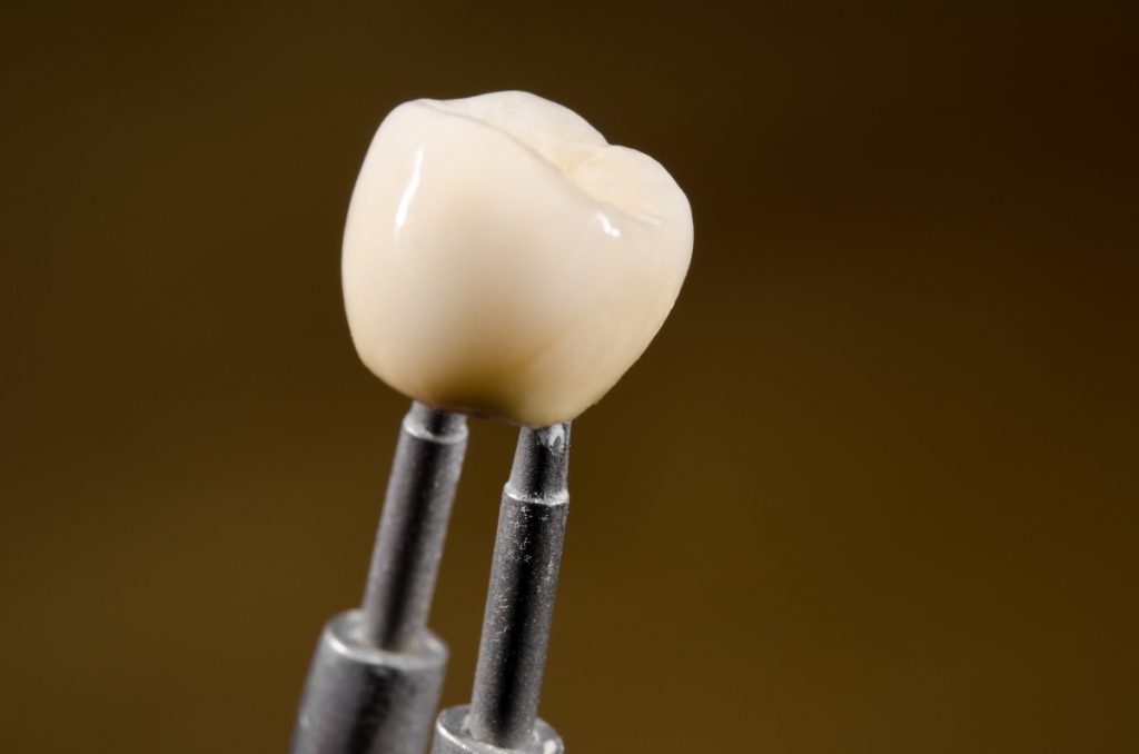 dental implant